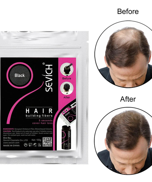 Sevich 100g Hair Fibers Refill