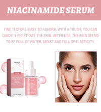 Niacinamide Serum – Dark Spot Corrector & Pore Minimizer