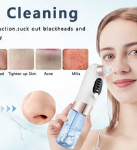 Blackhead Remover Pore Vacuum – USB Rechargeable Face Cleaner