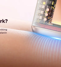 IPL Laser Hair Removal Device – 990,000 Flashes for Men & Women