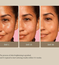 Turmeric Kojic Acid Glow Soap – Dark Spot & Acne Removal