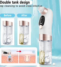 Blackhead Remover Pore Vacuum – USB Rechargeable Face Cleaner