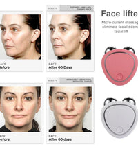 Electric EMS Facial Lifting Roller – Microcurrent Skin Tightening