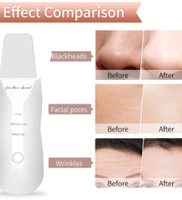 Ultrasonic Skin Scraper – Blackhead & Deep Pore Cleaner