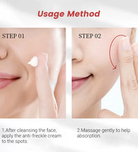 20g Whitening Freckle Cream – Dark Spot Remover & Skin Brightening Serum