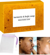 Turmeric Kojic Acid Glow Soap – Dark Spot & Acne Removal