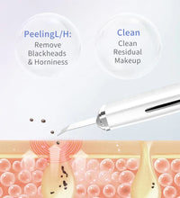 Ultrasonic Skin Scraper – Blackhead & Deep Pore Cleaner