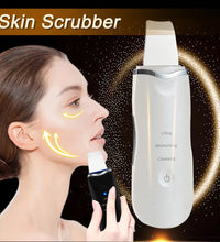 Ultrasonic Skin Scraper – Blackhead & Deep Pore Cleaner