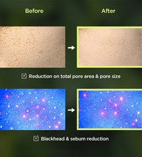 Korean Heartleaf Anua Anti-Aging Essence & Skin Care Set – Toner, Emulsion & Cleanser