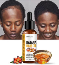 Lewedo Naturals Pure Batana Oil – Fast Hair Growth & Anti Hair Loss