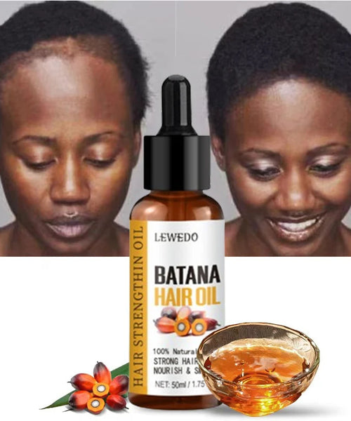 Lewedo Naturals Pure Batana Oil – Fast Hair Growth & Anti Hair Loss