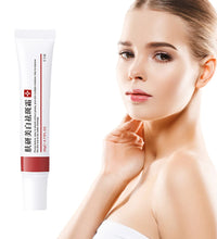 20g Whitening Freckle Cream – Dark Spot Remover & Skin Brightening Serum