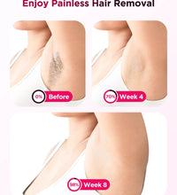 IPL Laser Hair Removal Device – 990,000 Flashes for Men & Women