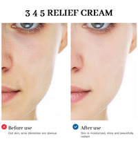 345 Relief Cream – Brightening, Anti-Acne & Moisturizing Skincare