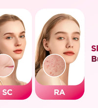 IPL Laser Hair Removal Device – 990,000 Flashes for Men & Women