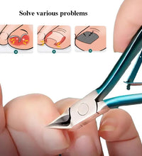 Ingrown Toenail Clippers – Thick Nail & Dead Skin Trimmer