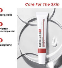 20g Whitening Freckle Cream – Dark Spot Remover & Skin Brightening Serum