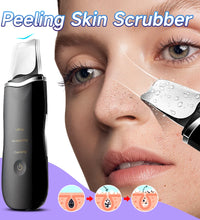 Ultrasonic Skin Scraper – Blackhead & Deep Pore Cleaner